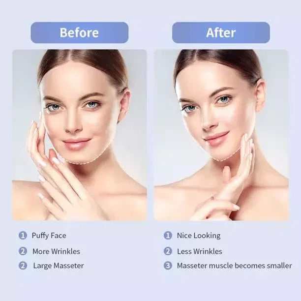 Electric V- Face Shaping Massager Double Chin Reducer Face Lifting Machine