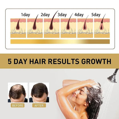 Sakura Hair Growth Shampoo - Buy 1 Get 1 Free